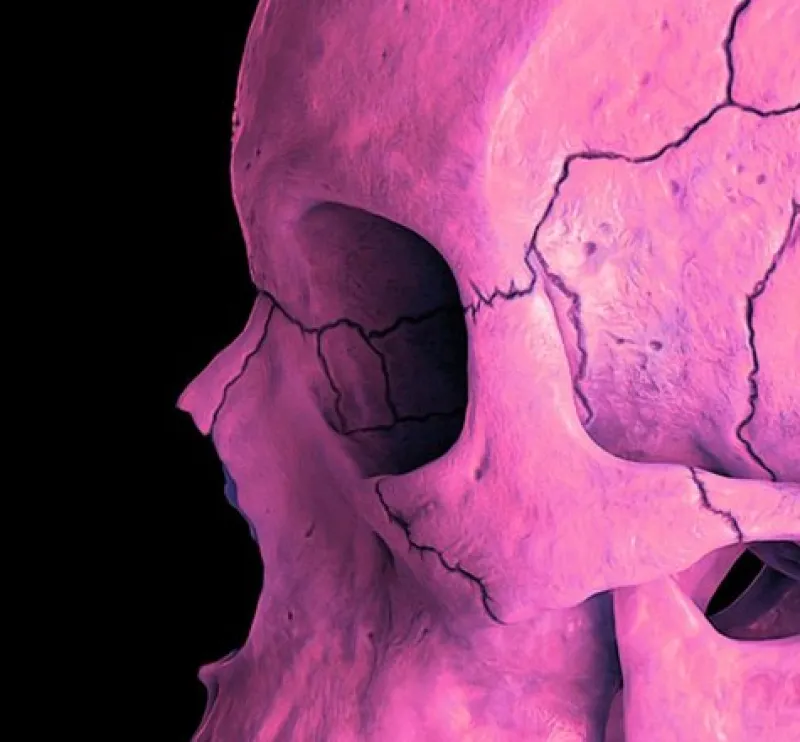 Online Pamono Mr Strange, Death in Pink, 2021, Giclée on Aludibond